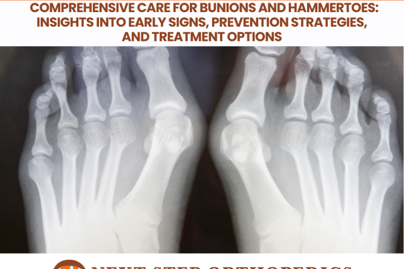 Comprehensive Care for Bunions and Hammertoes Insights into Early Signs, Prevention Strategies, and Treatment Options